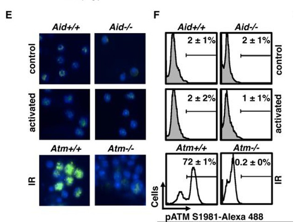 Immunofluorescence using ATM S1981
